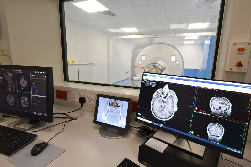 Two PC monitors, showing MRI scans.