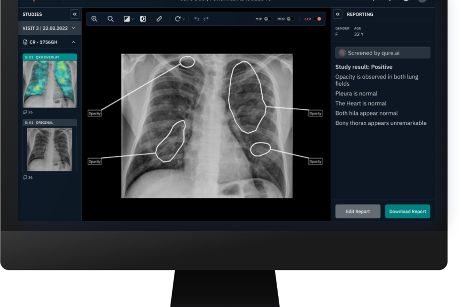 Image of computer screen showing the RADICAL AI-powered X-ray reporting system