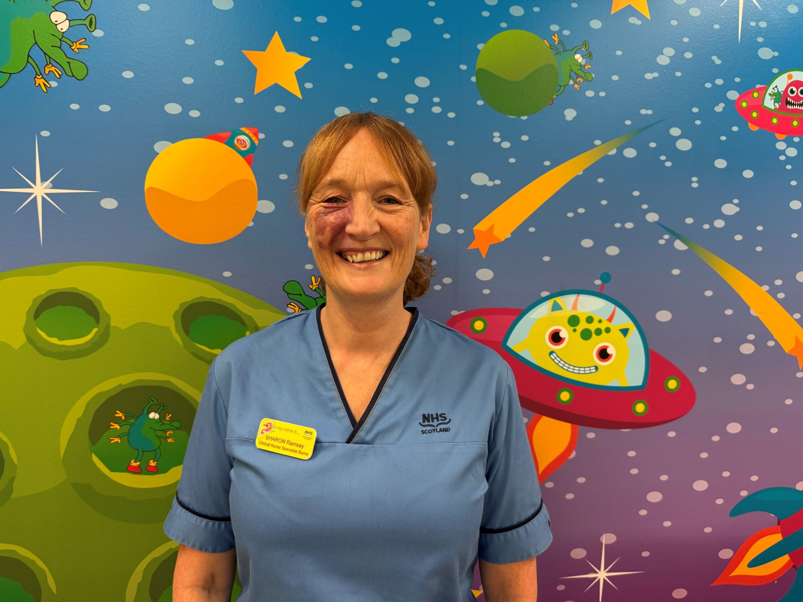 More than a third of Scotland’s firework injuries occurred in Greater Glasgow and Clyde last year